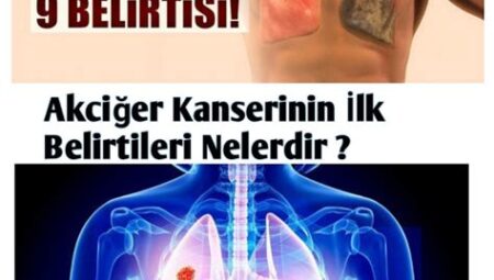 "Akciğer Kanseri Belirtileri Nelerdir?"